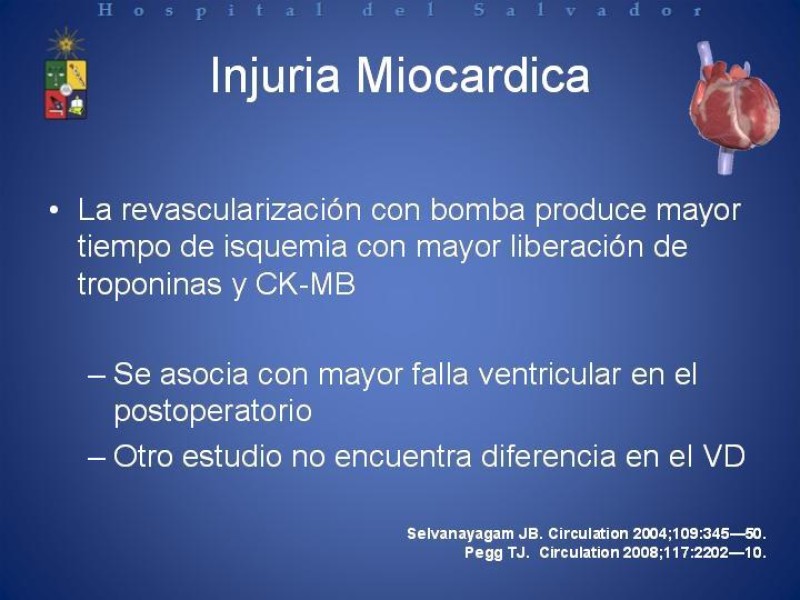 Diapositiva 9 de Estado Actual de la Revascularización Miocárdica sin Circulación Extracorpórea