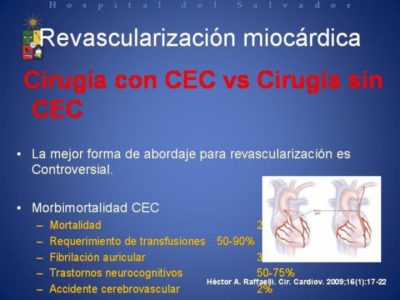 Diapositiva 3 de Estado Actual de la Revascularización Miocárdica sin Circulación Extracorpórea