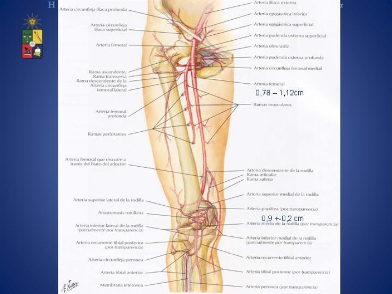 Diapositiva 2 de Aneurismas Arteriales de Extremidades Inferiores 