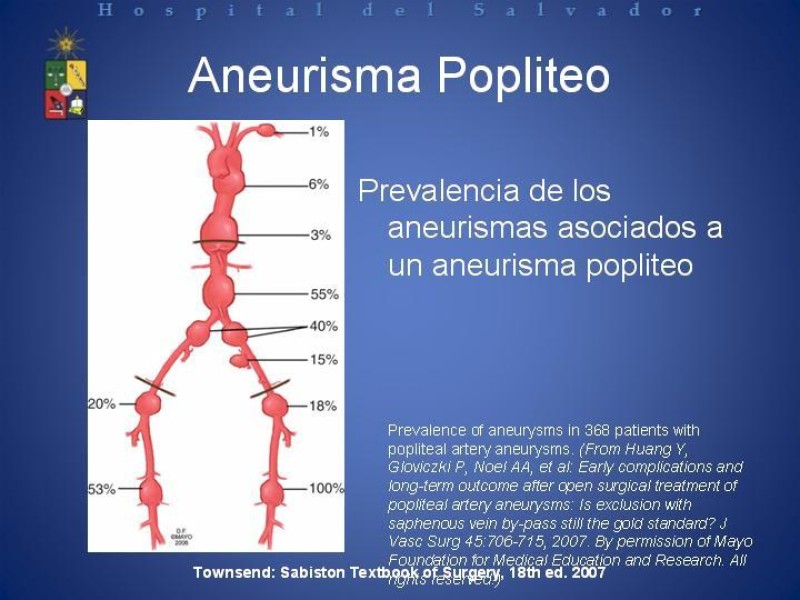 Diapositiva 9 de Aneurismas Arteriales de Extremidades Inferiores 