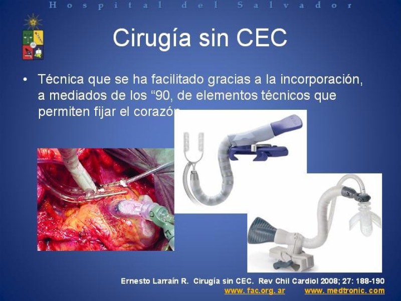 Diapositiva 5 de Estado Actual de la Revascularización Miocárdica sin Circulación Extracorpórea