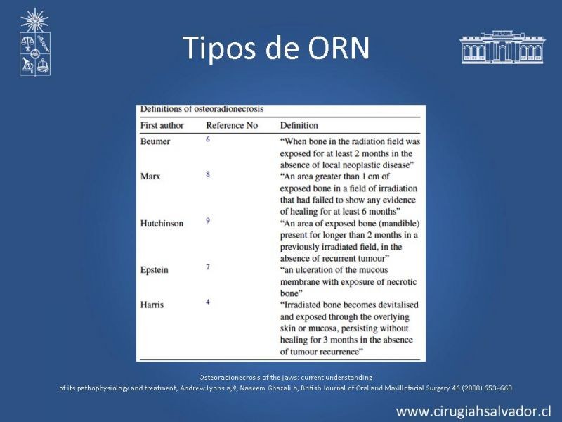 Diapositiva 9 de Osteorradionecrosis