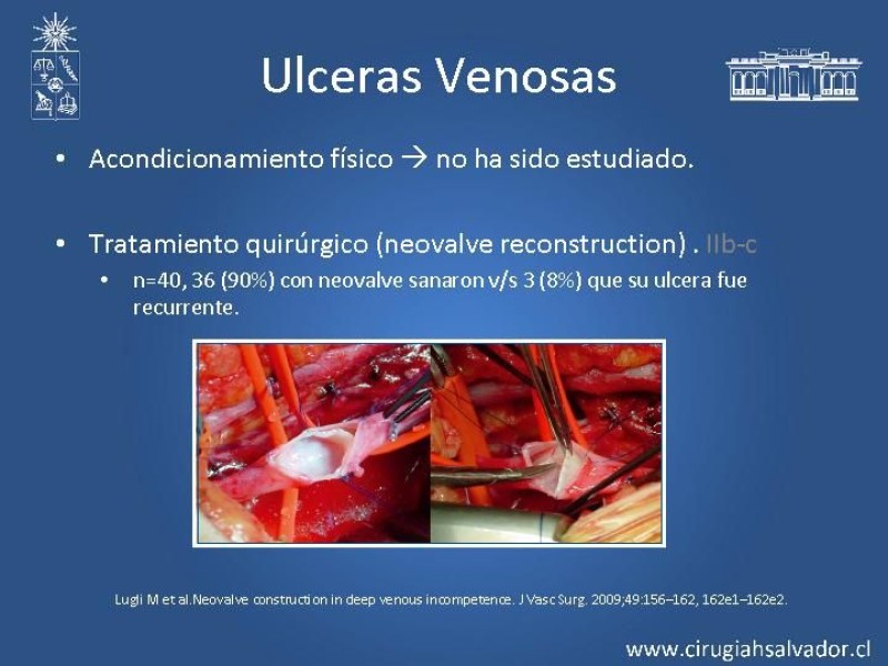 Diapositiva 20 de Síndrome Postrombótico