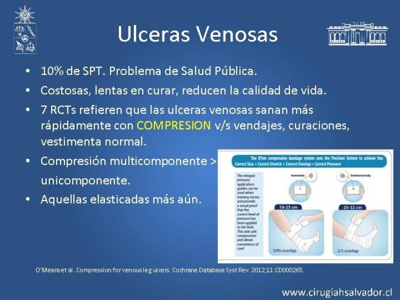 Diapositiva 18 de Síndrome Postrombótico