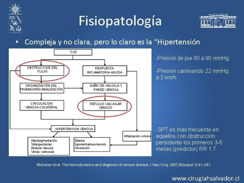 Diapositiva 4 de Síndrome Postrombótico