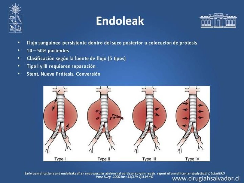 Diapositiva 10 de Complicaciones de EVAR