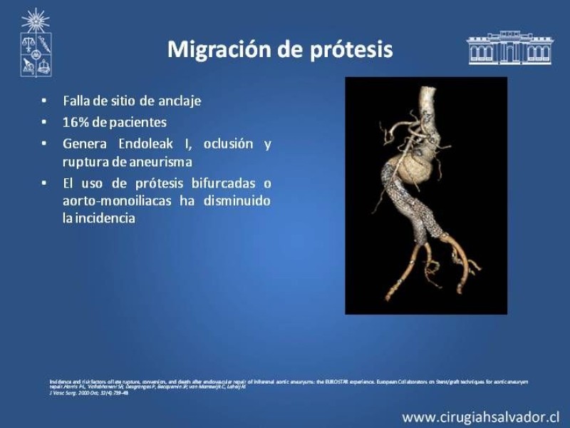 Diapositiva 12 de Complicaciones de EVAR