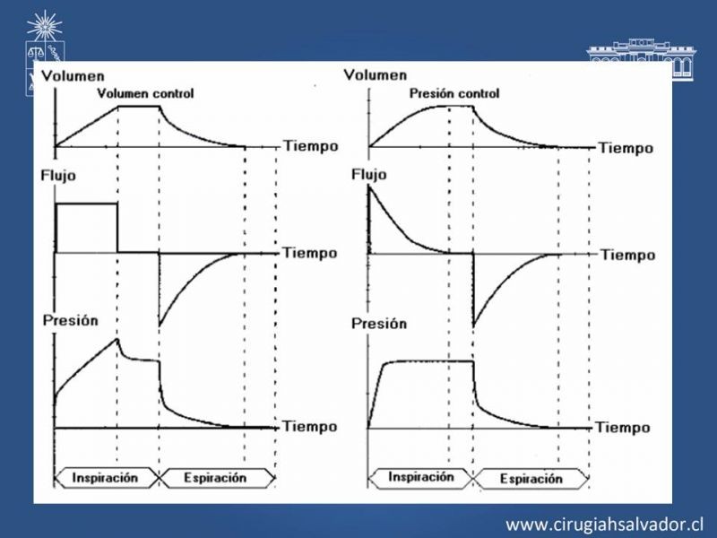Diapositiva 12 de VMI: Modos ventilatorios: Indicaciones y manejo