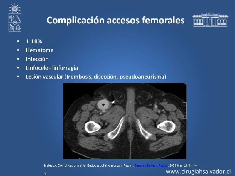 Diapositiva 16 de Complicaciones de EVAR