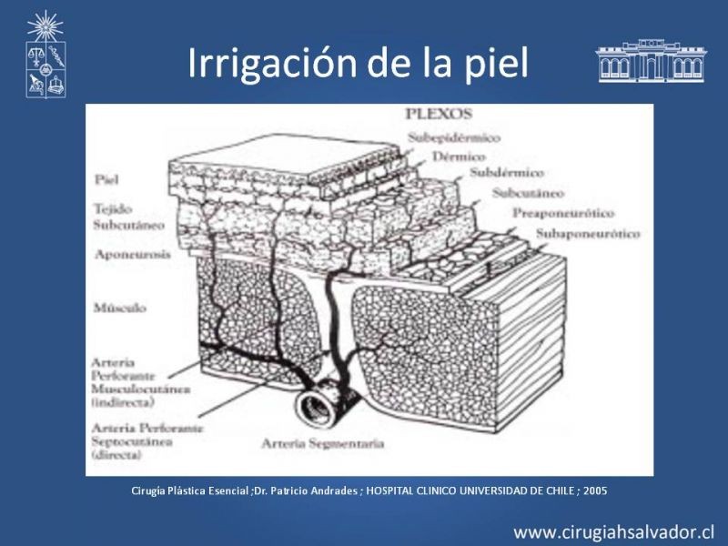 Diapositiva 4 de Colgajos musculocutáneos