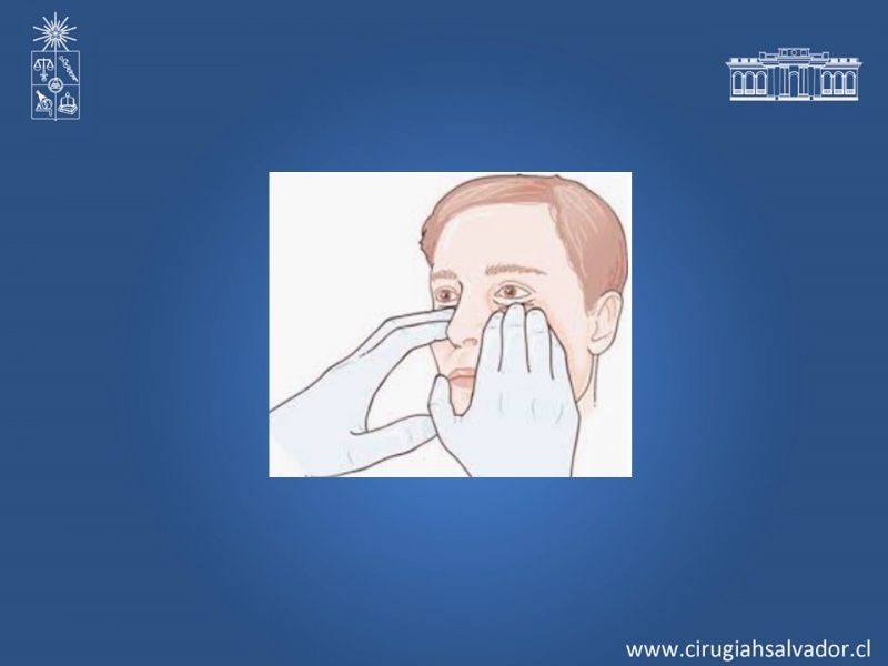 Diapositiva 14 de Trauma Maxilofacial