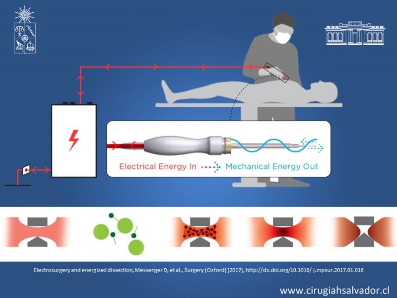 Diapositiva 18 de Electrocirugía y suturas mecánicas