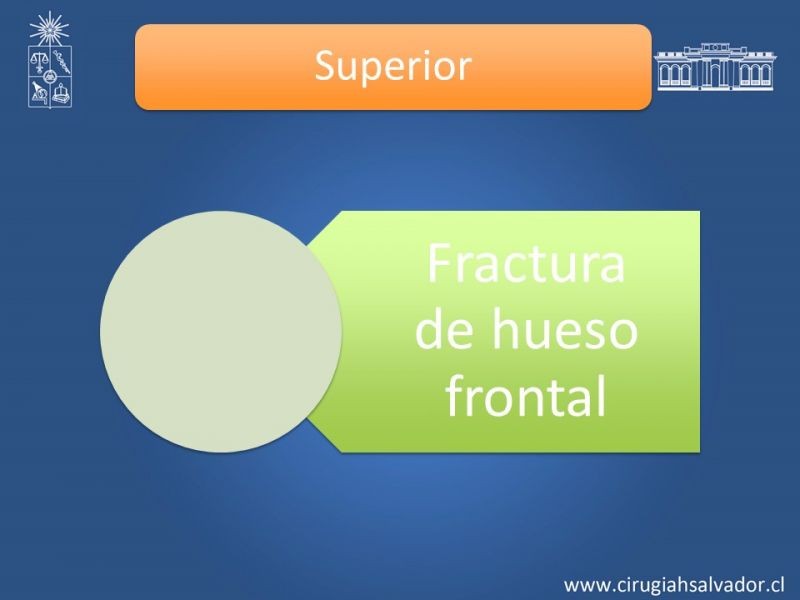 Diapositiva 18 de Trauma Maxilofacial