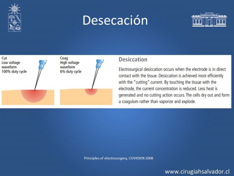 Diapositiva 10 de Electrocirugía y suturas mecánicas