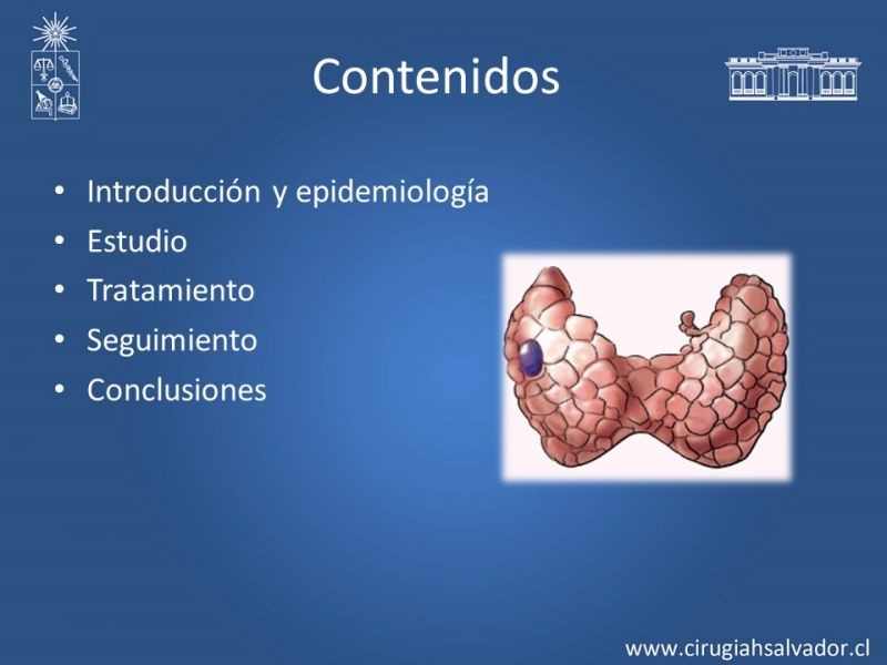 Diapositiva 1 de Nódulo Tiroídeo