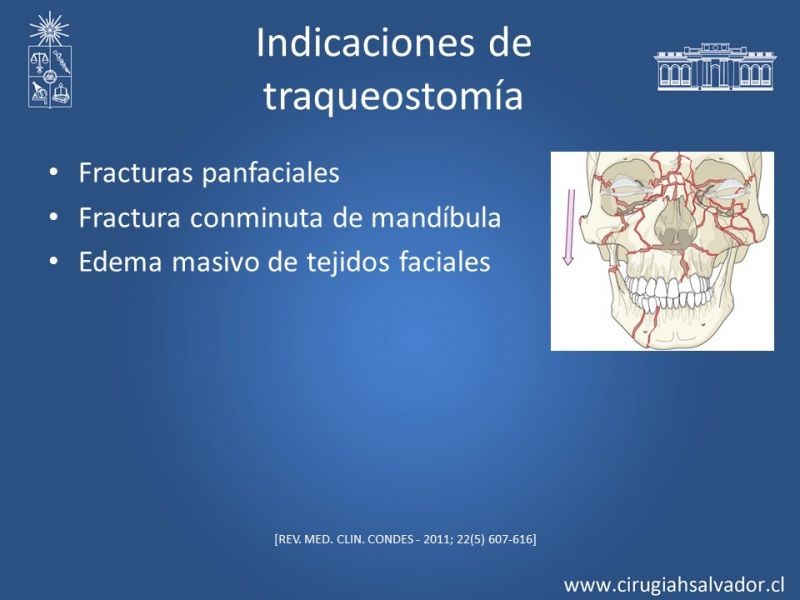 Diapositiva 15 de Trauma Maxilofacial