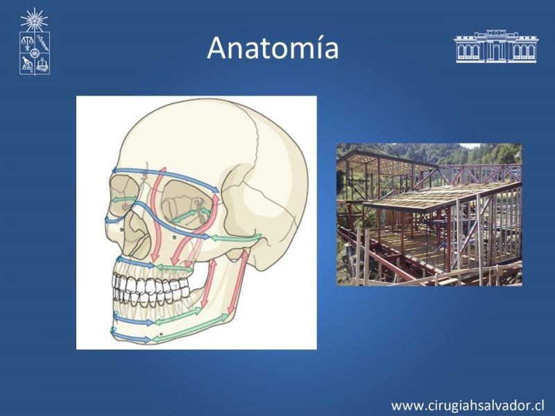 Diapositiva 4 de Trauma Maxilofacial