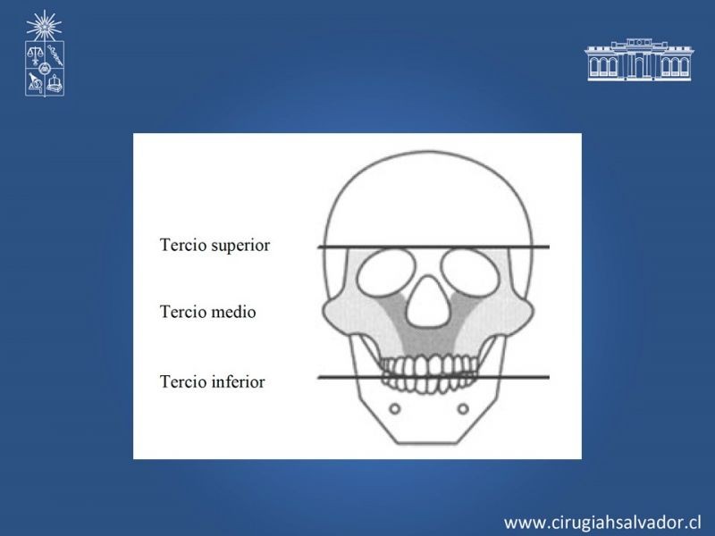 Diapositiva 17 de Trauma Maxilofacial