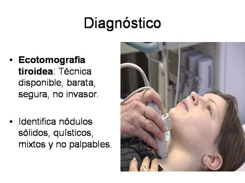 Diapositiva 9 de Cáncer de Tiroides