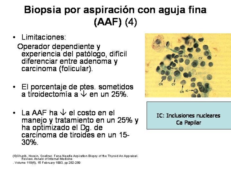 Diapositiva 12 de Cáncer de Tiroides