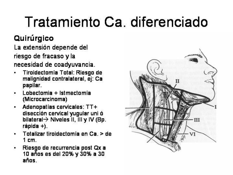 Diapositiva 28 de Cáncer de Tiroides