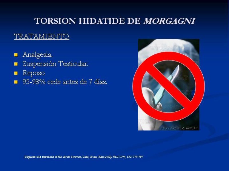 Diapositiva 14 de Síndrome de escroto agudo