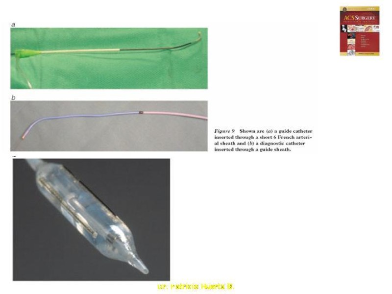 Diapositiva 20 de Enfermedad renovascular (ERV)