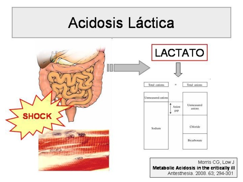 Diapositiva 15 de Trastorno Acido / Base