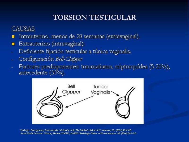 Diapositiva 6 de Síndrome de escroto agudo