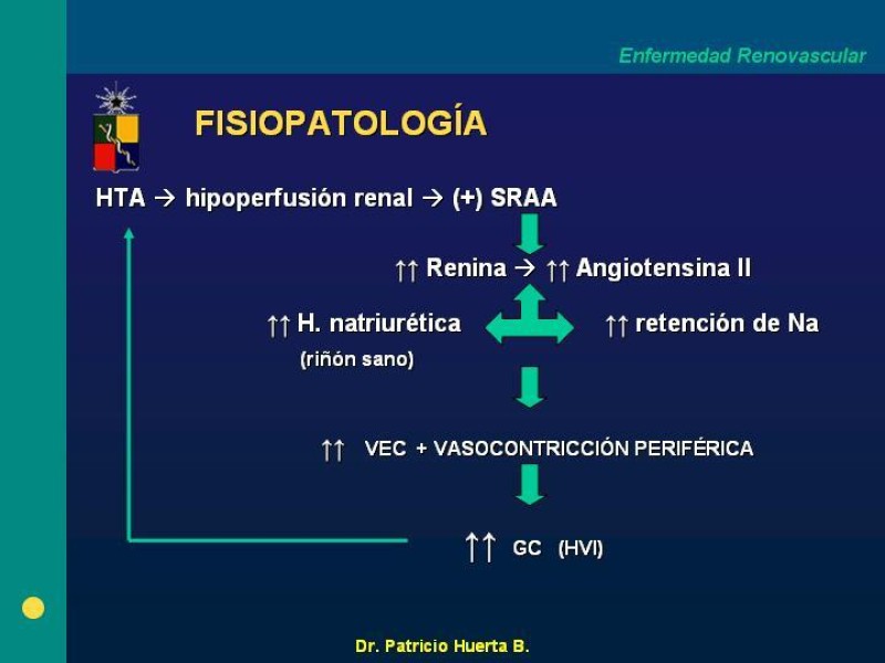 Diapositiva 6 de Enfermedad renovascular (ERV)