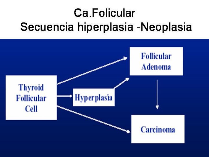 Diapositiva 21 de Cáncer de Tiroides