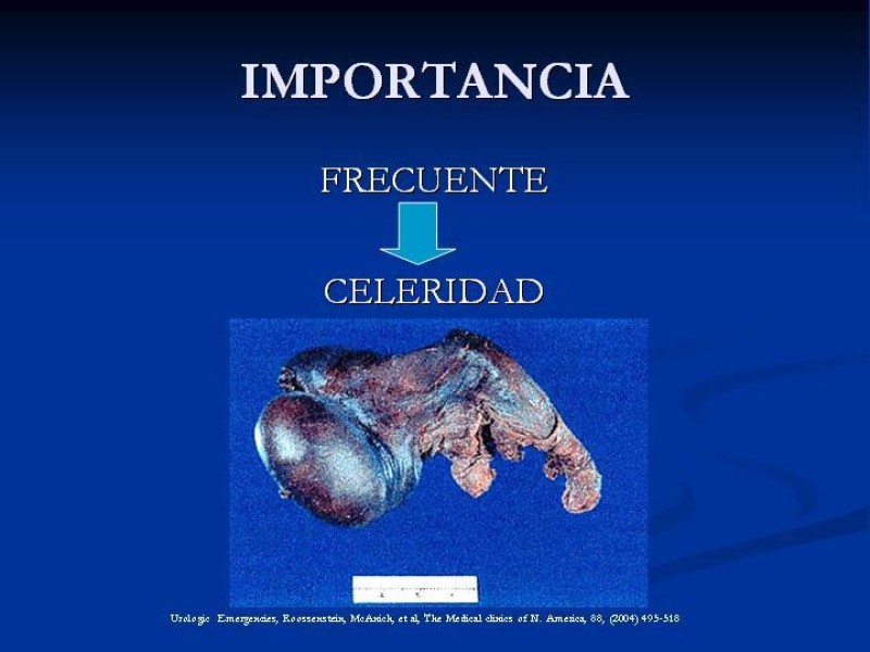 Diapositiva 2 de Síndrome de escroto agudo