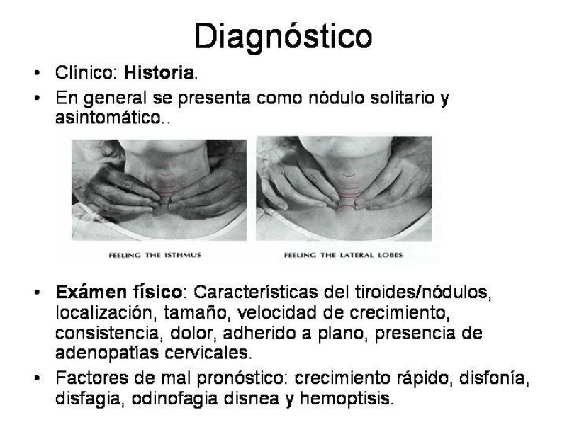 Diapositiva 8 de Cáncer de Tiroides