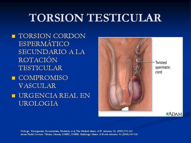Diapositiva 5 de Síndrome de escroto agudo