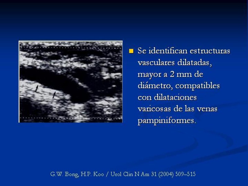 Diapositiva 24 de Síndrome de escroto agudo