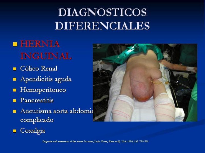 Diapositiva 28 de Síndrome de escroto agudo