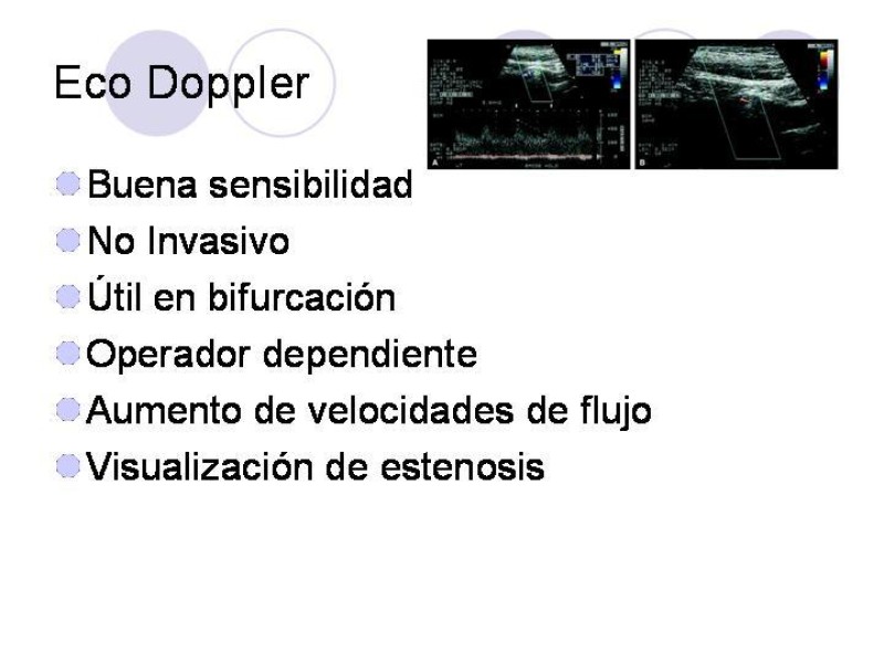 Diapositiva 7 de Estenosis Carotidea Endarterectomía y Angioplastía