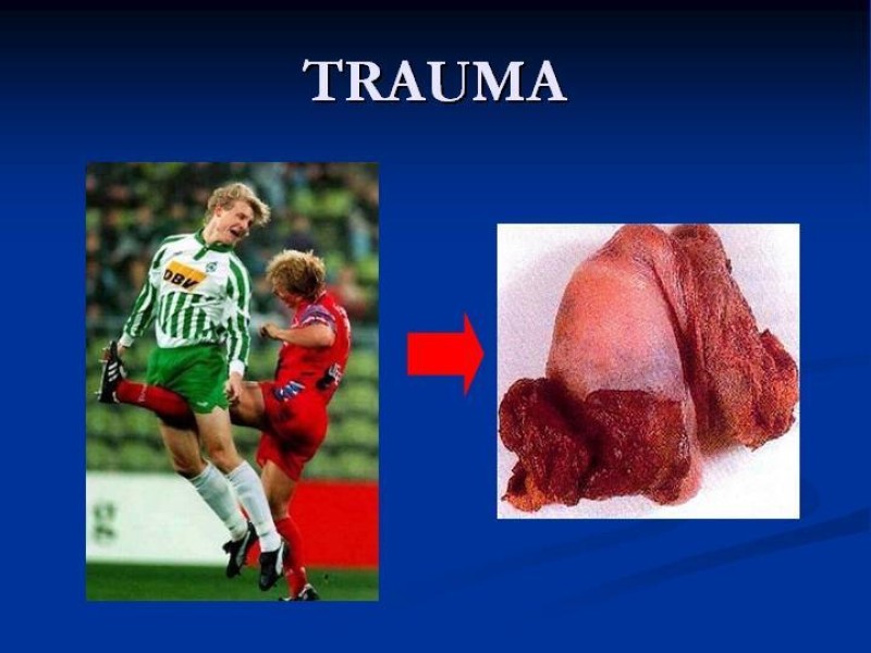 Diapositiva 27 de Síndrome de escroto agudo