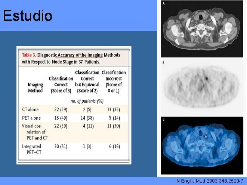 Diapositiva 26 de Cáncer Pulmonar