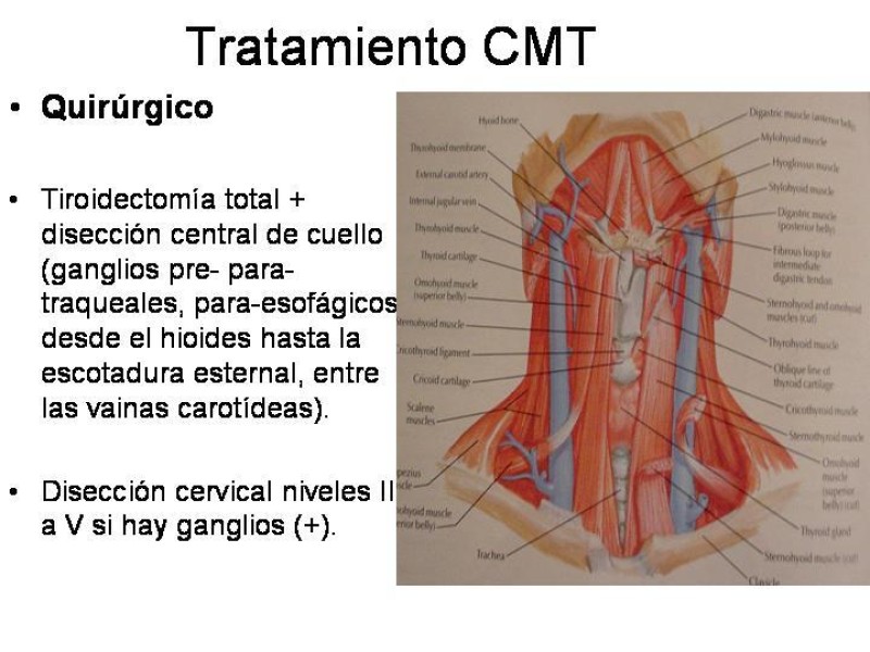 Diapositiva 35 de Cáncer de Tiroides