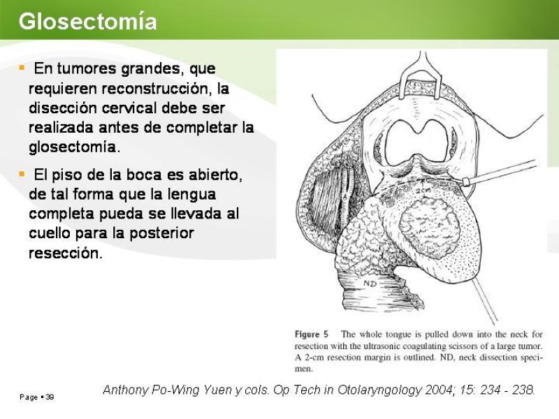 Diapositiva 38 de Cáncer de Lengua