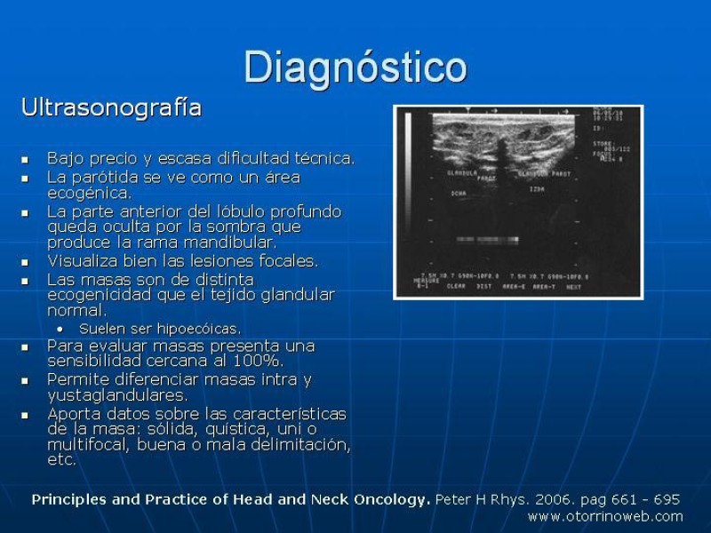 Diapositiva 12 de Tumores de las Glándulas Parótidas