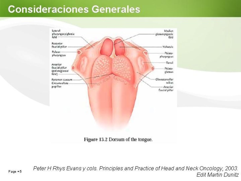 Diapositiva 4 de Cáncer de Lengua