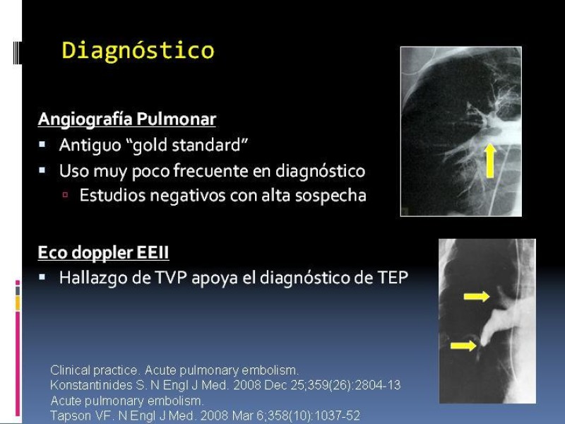 Diapositiva 19 de TEP y su profilaxis en cirugía