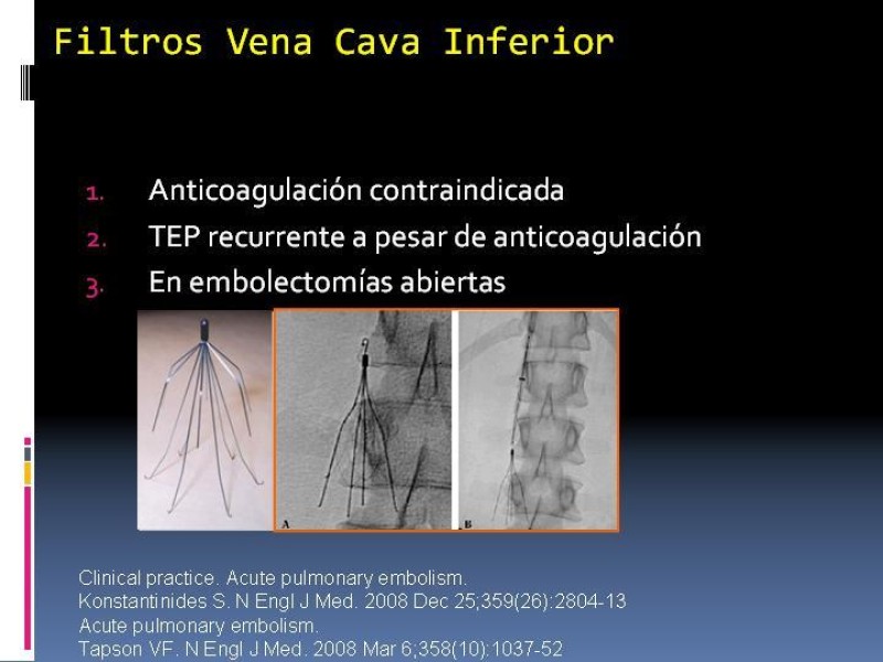 Diapositiva 28 de TEP y su profilaxis en cirugía