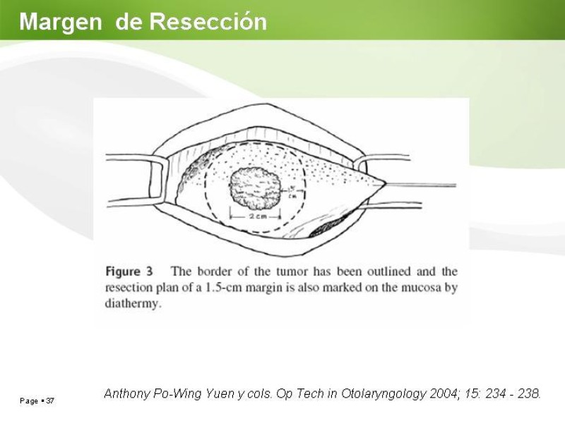 Diapositiva 36 de Cáncer de Lengua