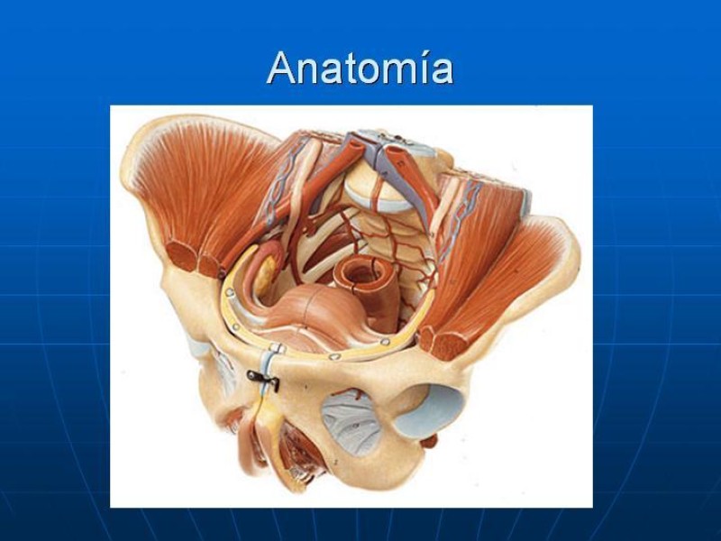Diapositiva 3 de Fractura de Pelvis