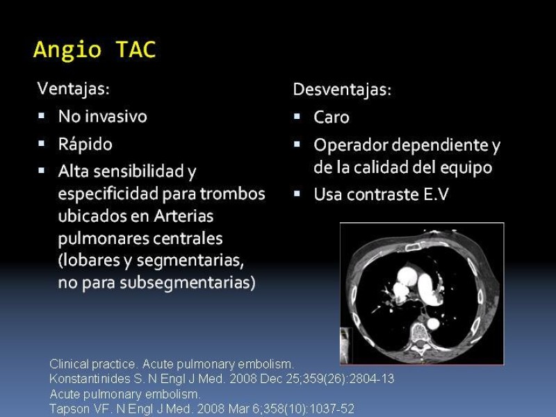 Diapositiva 17 de TEP y su profilaxis en cirugía