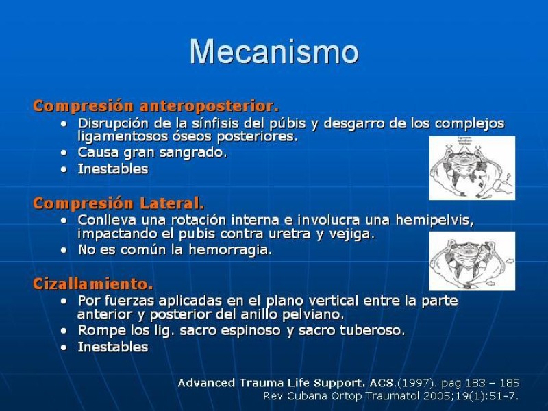 Diapositiva 6 de Fractura de Pelvis