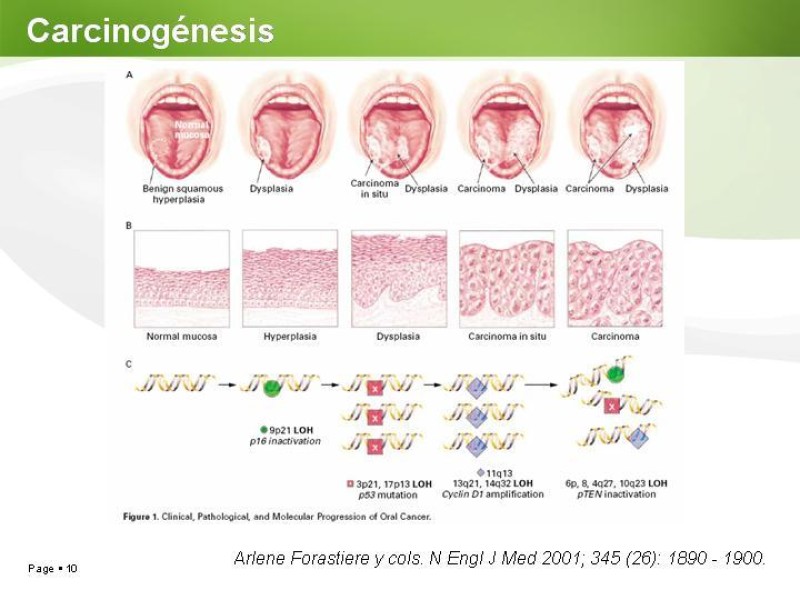 Diapositiva 9 de Cáncer de Lengua